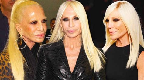 mann von donatella versace|Donatella Versace face what happened.